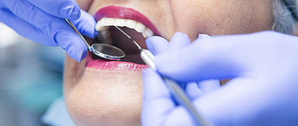 Best Emergency Treatment for Toothache in Perry, OH